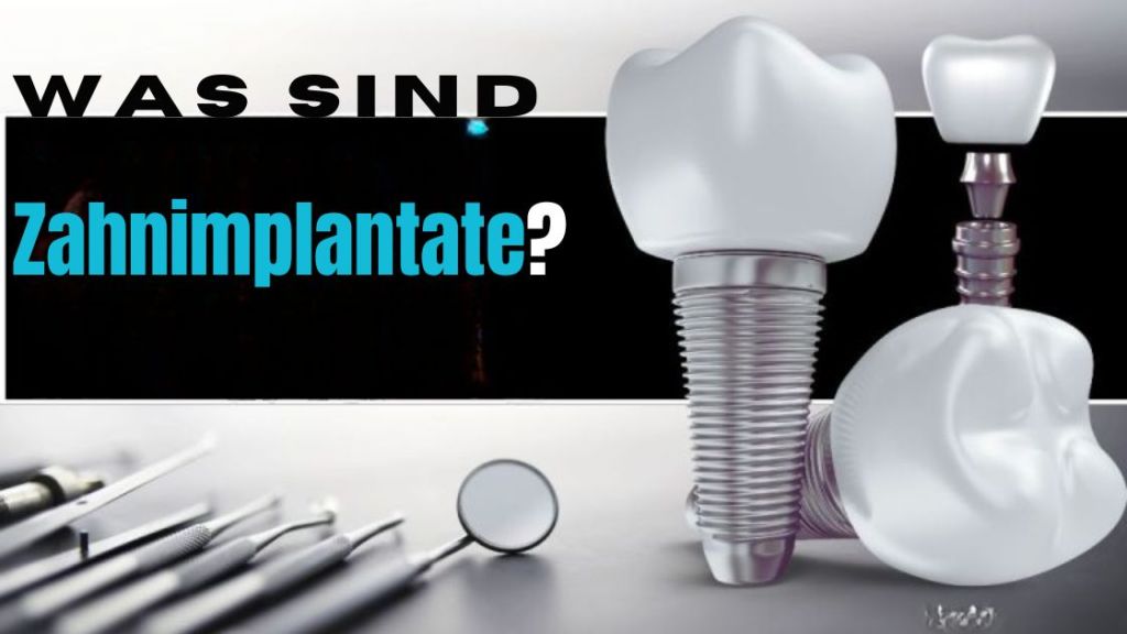 Was sind Zahnimplantate?