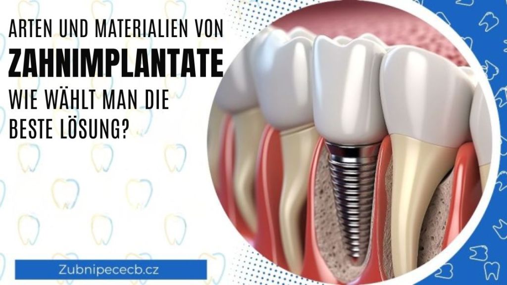 Arten und Materialien von Zahnimplantaten: Wie wählt man die beste Lösung?