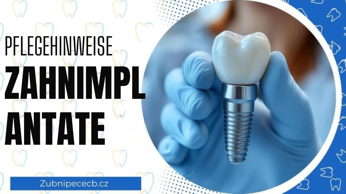 Wie man Zahnimplantate pflegt