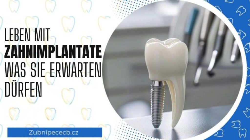 Leben mit einem Zahnimplantat: Was Sie beim Sprechen und Essen erwartet und wie sich das auf Ihr Selbstvertrauen auswirkt 