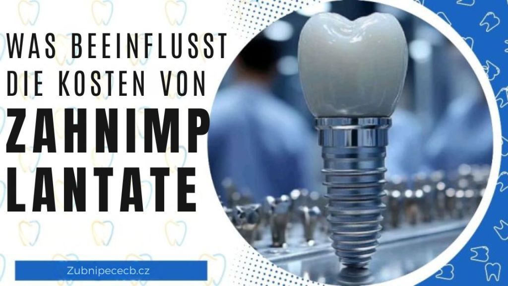 Was den Preis eines Zahnimplantats beeinflusst – und warum es sich nicht lohnt, hier zu sparen