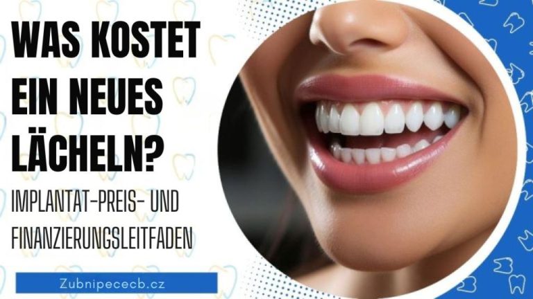 Was kostet ein neues Lächeln? Ratgeber zu Implantatpreisen und Finanzierungsmöglichkeiten