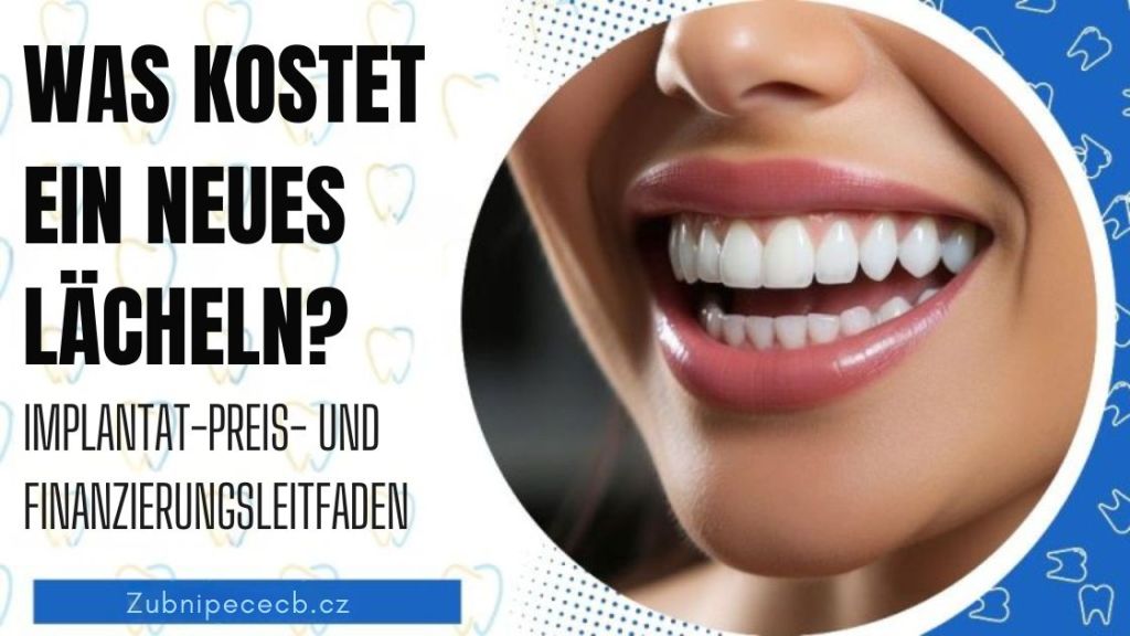Was kostet ein neues Lächeln? Ratgeber zu Implantatpreisen und Finanzierungsmöglichkeiten