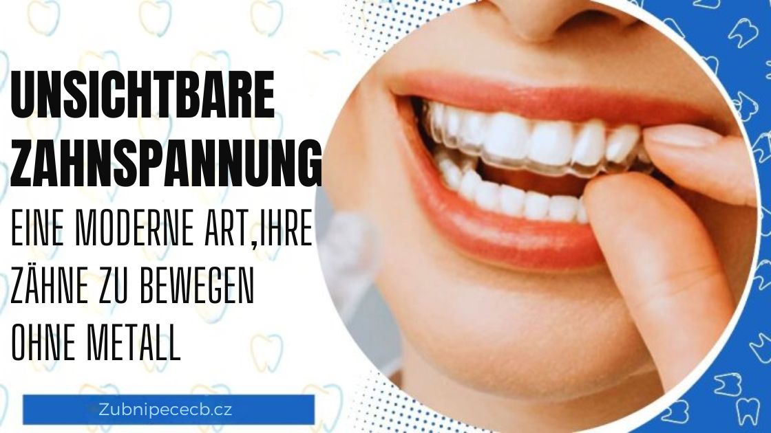 Unsichtbare Zahnspangen: Erfahrungen