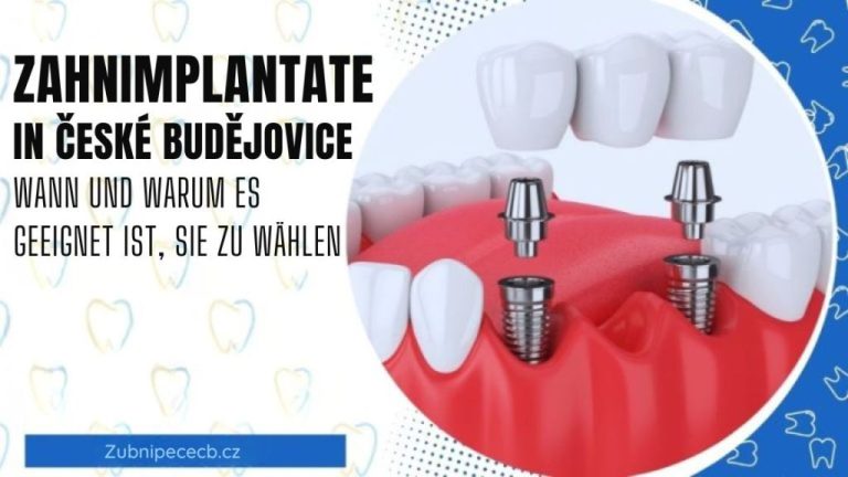 Zahnimplantate in České Budějovice – wann und warum sie eine sinnvolle Wahl sind