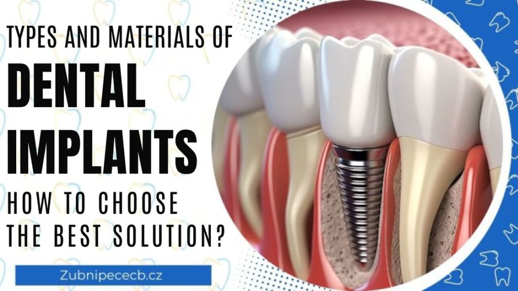 Types and materials of dental implants: How to choose the best solution?