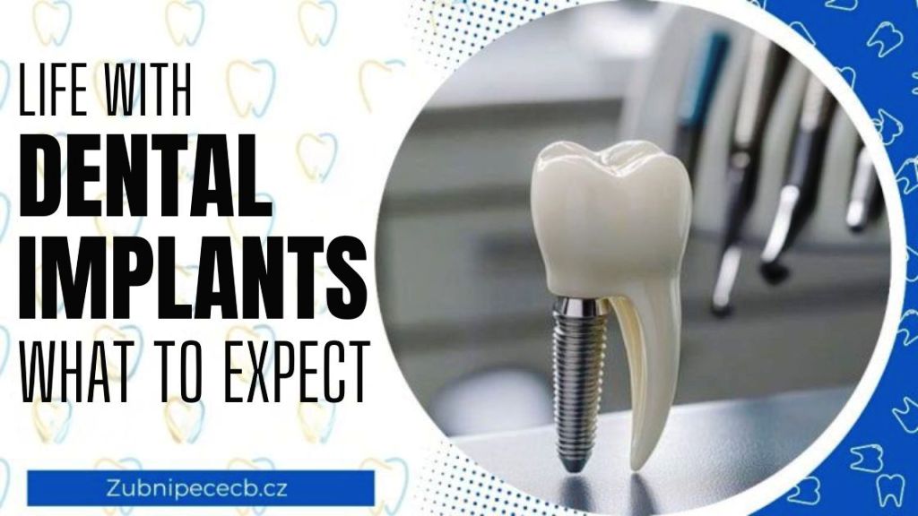 Living with a dental implant: what to expect when speaking, eating, and how it will affect your self-confidence 