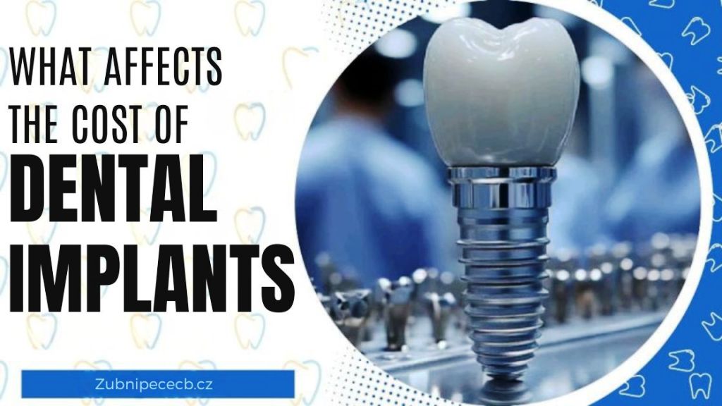 What affects the price of a dental implant – and why it’s not worth saving on them
