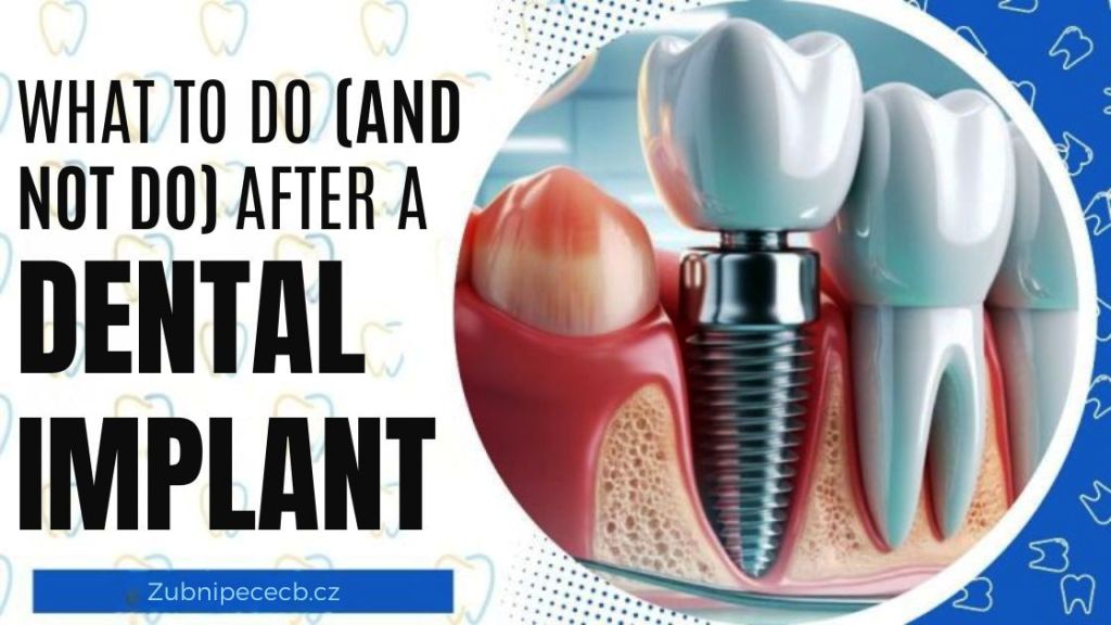 What you should (and shouldn’t) do after a dental implant: A guide for the first few weeks