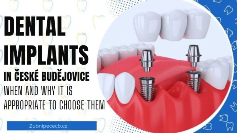 Dental implants in České Budějovice – when and why they are a sensible choice