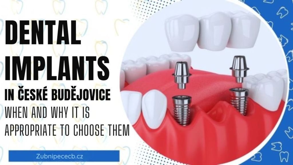 Dental implants in České Budějovice – when and why they are a sensible choice