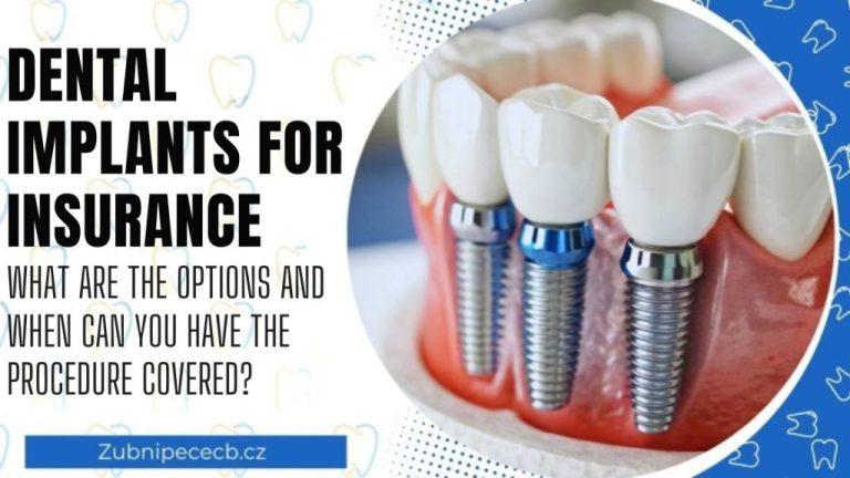 Dental implants with insurance coverage: What options are available and when is the procedure covered by insurance?