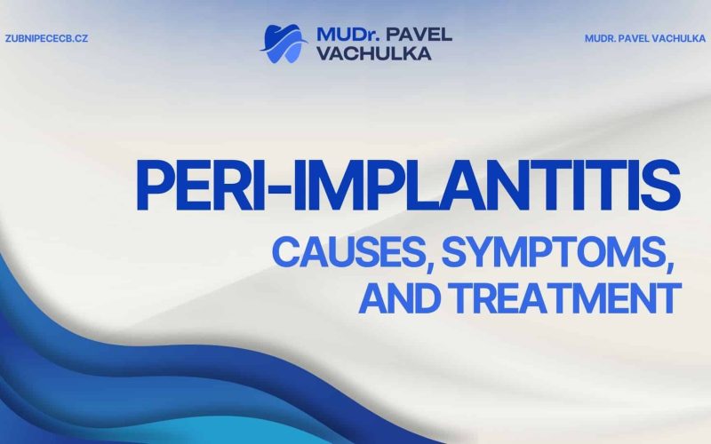 Peri-implantitis: Causes, Symptoms and Treatment of Inflammation Around a Dental Implant