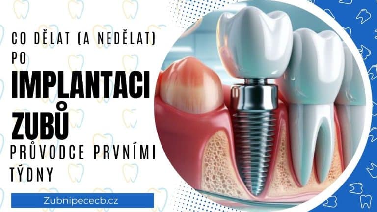 Co dělat (a nedělat) po implantaci zubů: Průvodce prvními týdny