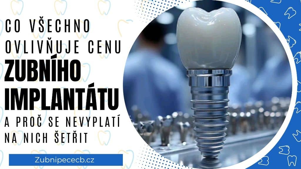 Co všechno ovlivňuje cenu zubního implantátu – a proč se nevyplatí na nich šetřit