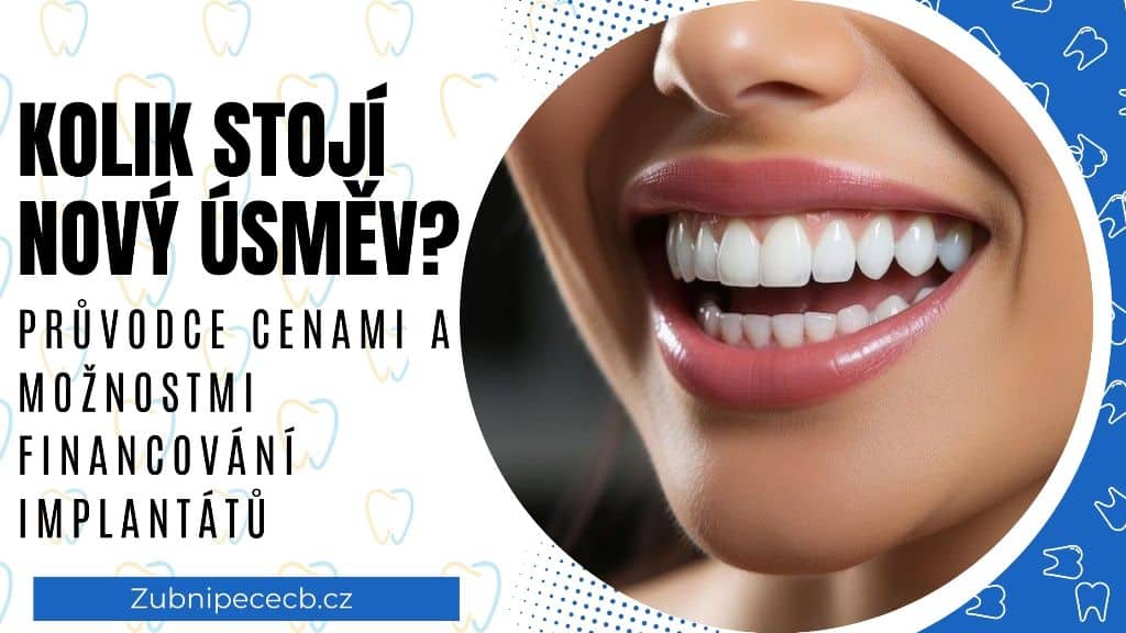 Kolik stojí nový úsměv? Průvodce cenami a možnostmi financování implantátů