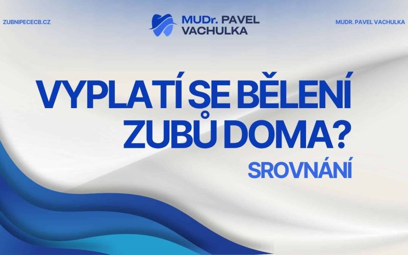 Domácí vs. profesionální bělení zubů – co se skutečně vyplatí?