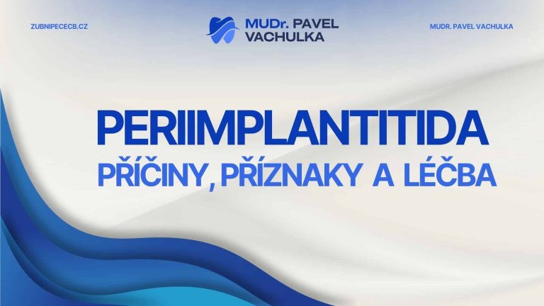 Periimplantitida: příčiny, příznaky a léčba zánětu kolem implantátu
