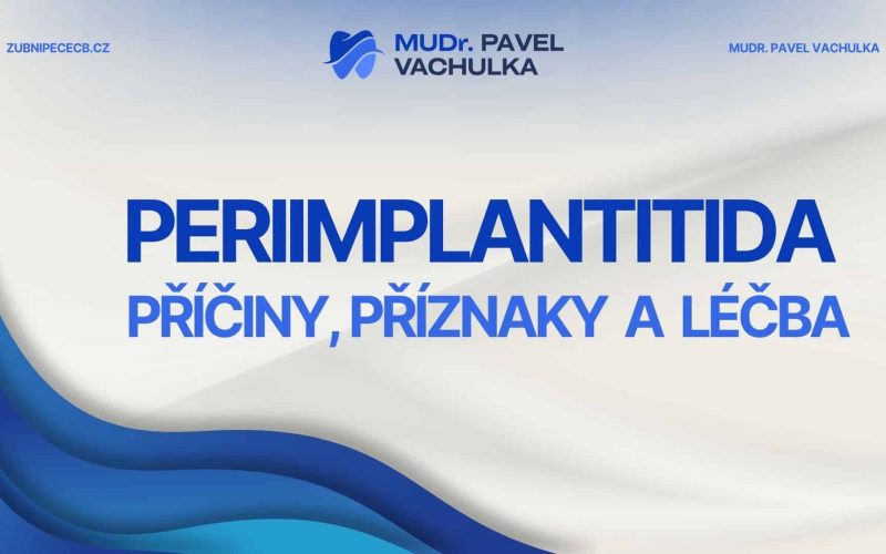 Periimplantitida: příčiny, příznaky a léčba zánětu kolem implantátu