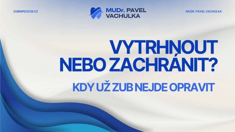 Vytrhnout, nebo zachránit? Kdy už zub nejde opravit